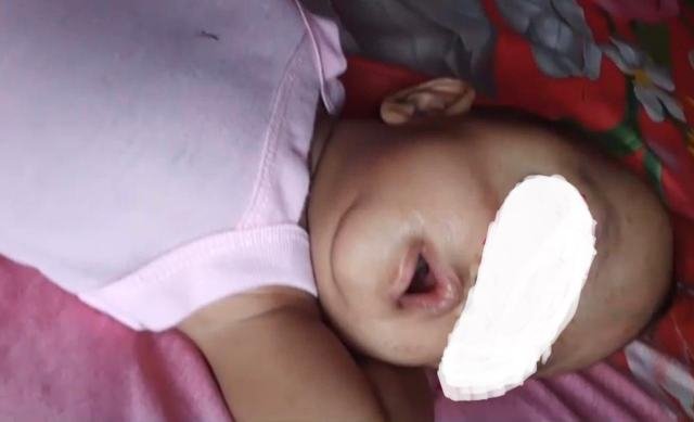 Pemkab beserta DPRD Madina menggalang donasi untuk pengobatan anak mengidap kanker mata yang dirawat di RS M Jamil Padang. 