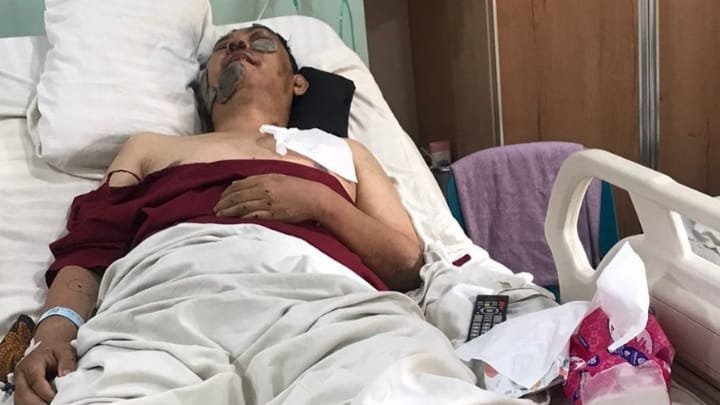 Andi, korban kecelakaan di Medan.